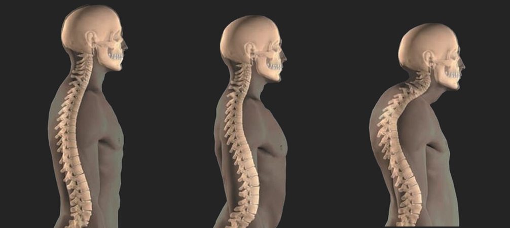 Как ведет себя вдовий горб со временем Как ведет себя вдовий горб со временем