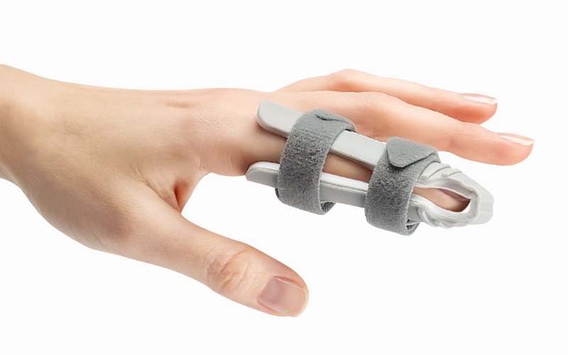 Ортезы vs Гипс: как выбрать и использовать ортез для быстрого восстановления