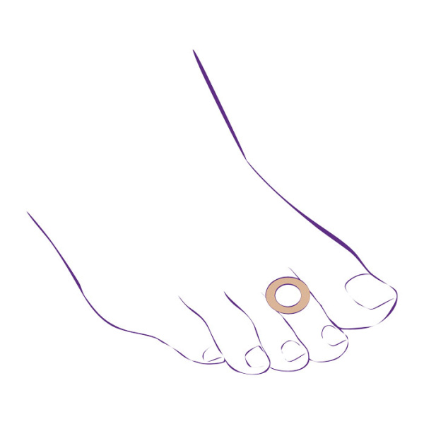 Протектор-кольцо от мозолей СТ-63  Trives