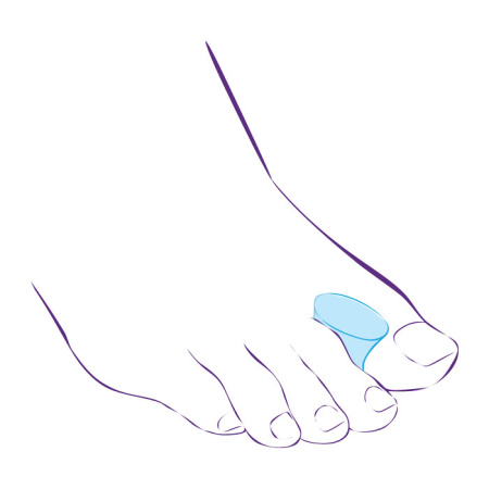 Межпальцевая перегородка СТ-31  Trives